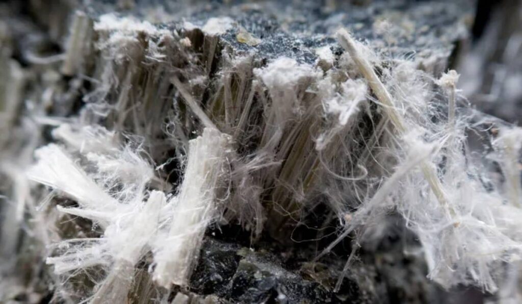 asbestosis
