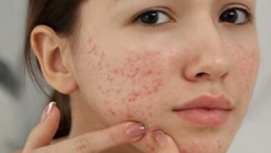 Which Ayurvedic Therapies Should You Try To Get Radiant Skin At Home