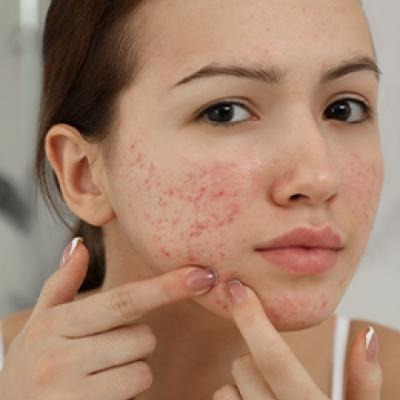 Which Ayurvedic Therapies Should You Try To Get Radiant Skin At Home