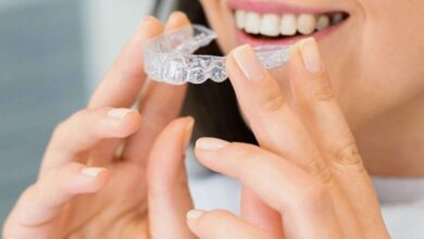Invisalign